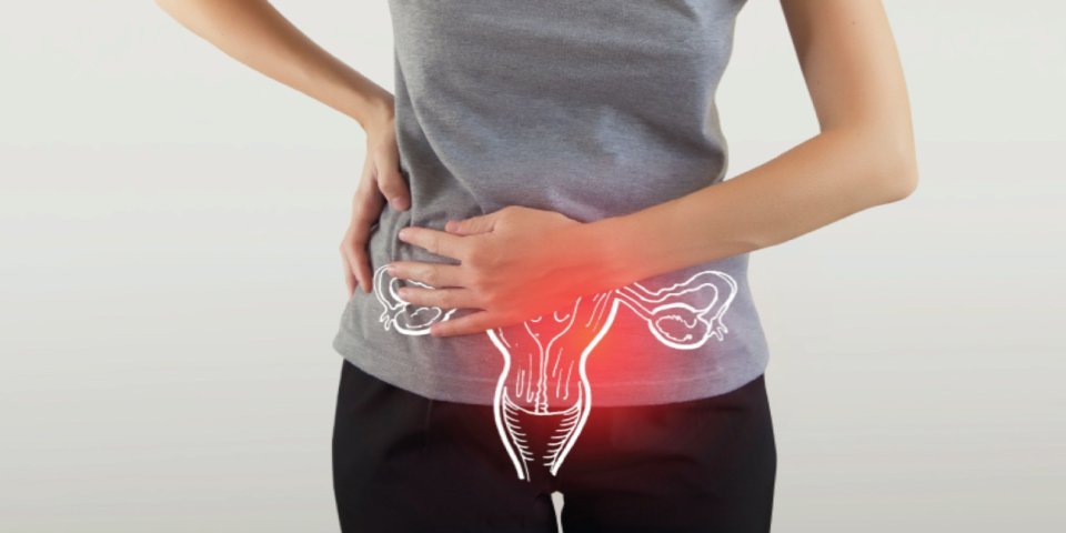 PCODPCOSRelated Pain & Discomfort