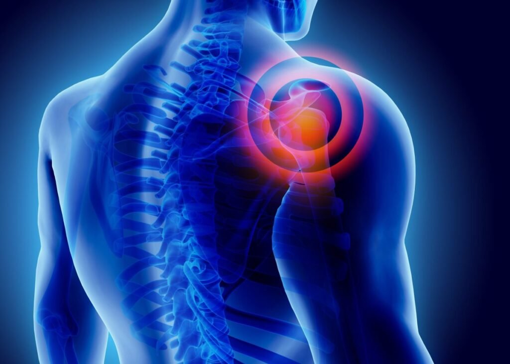 Shoulder Pain 2