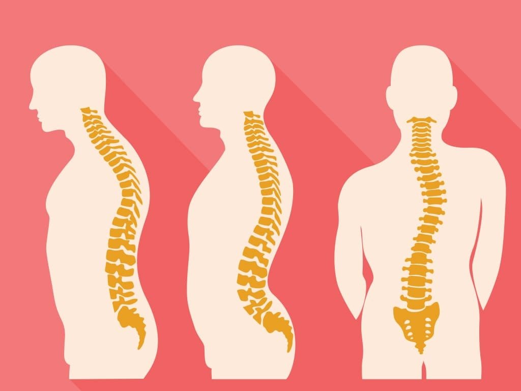 Spine Disorders 2